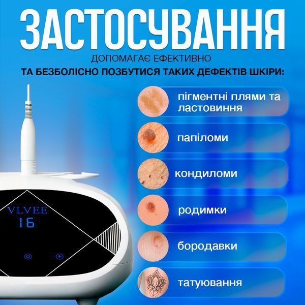 Косметологічний прилад VLVEE для догляду за шкірою обличчя та тіла (плазмова ручка) VLV-5163 фото