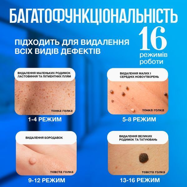 Косметологічний прилад VLVEE для догляду за шкірою обличчя та тіла (плазмова ручка) VLV-5163 фото