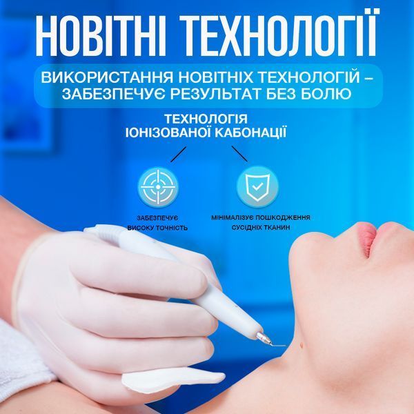 Косметологічний прилад VLVEE для догляду за шкірою обличчя та тіла (плазмова ручка) VLV-5163 фото